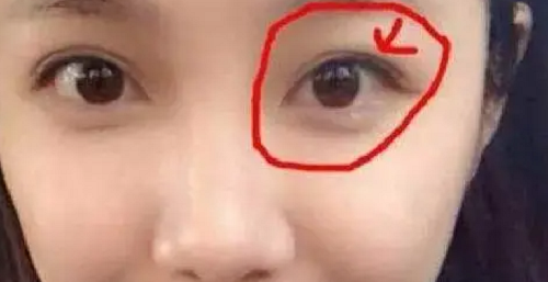 左眼皮上有痣的女人好不好 女人左眼皮上长有痣代表什么